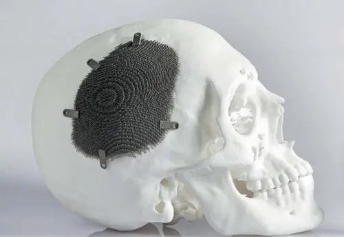 3d打印醫(yī)療